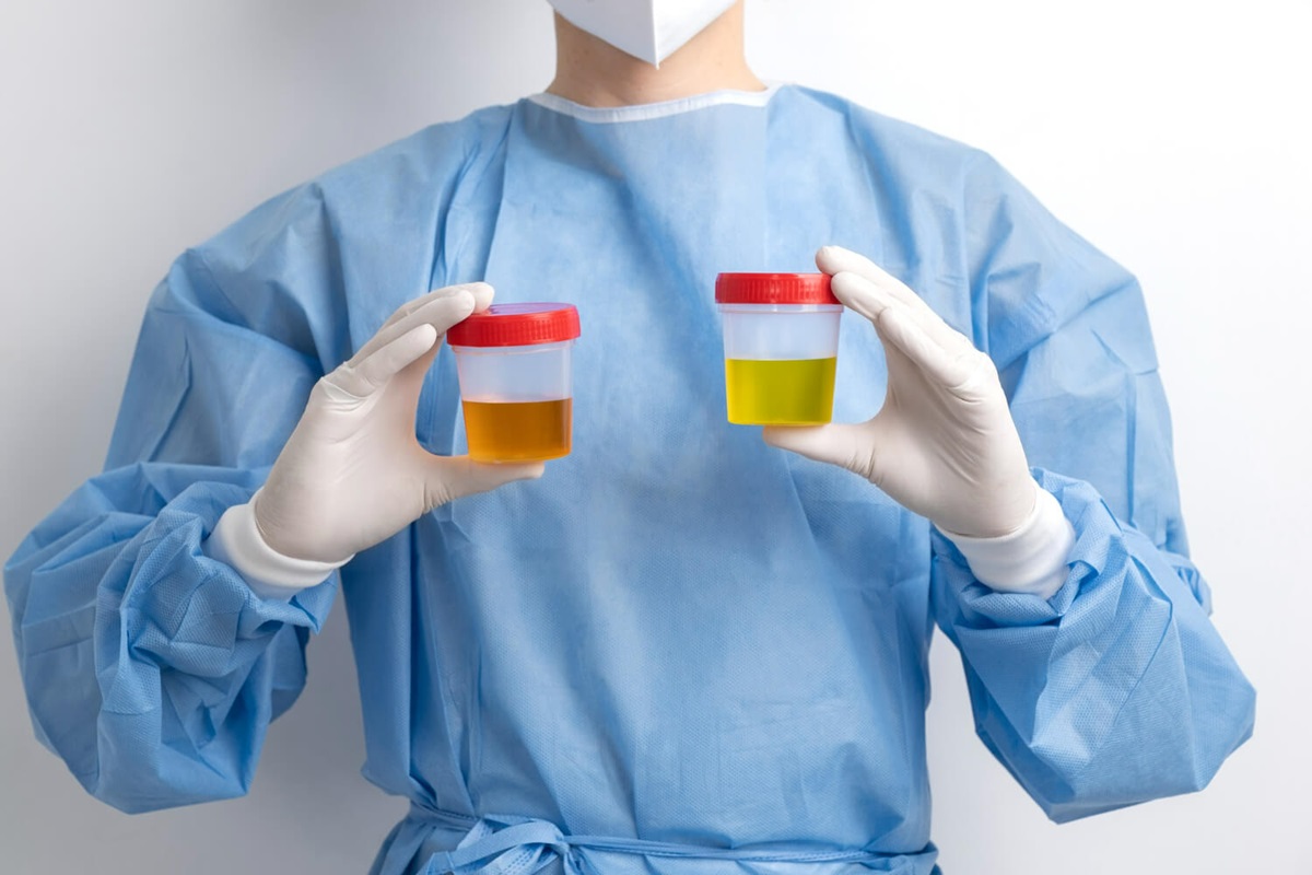 Doctor Holding Two Urine Samples